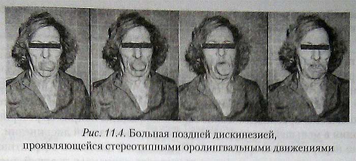 Лор Задать вопрос врачу Кчему снится выпадение зубов: сонник » - Сонник Пол к