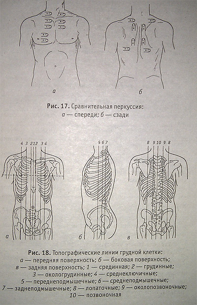 Перкуссии