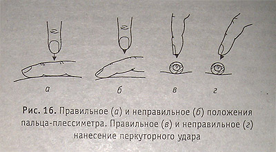 Положение рук при перкуссии