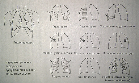 Аускультация легких, патологии