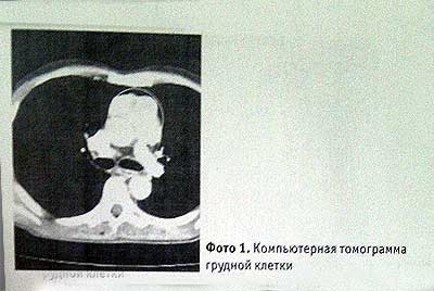 Компьютерная томография